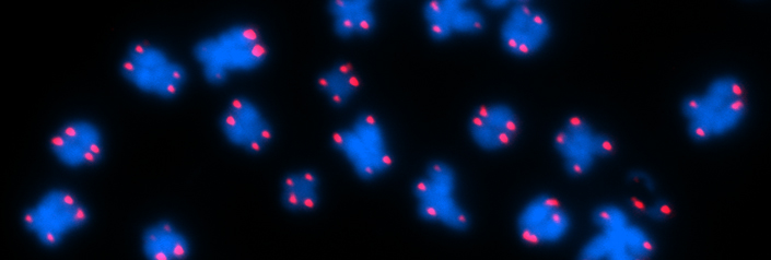 Microscopic Image of Chromosomes